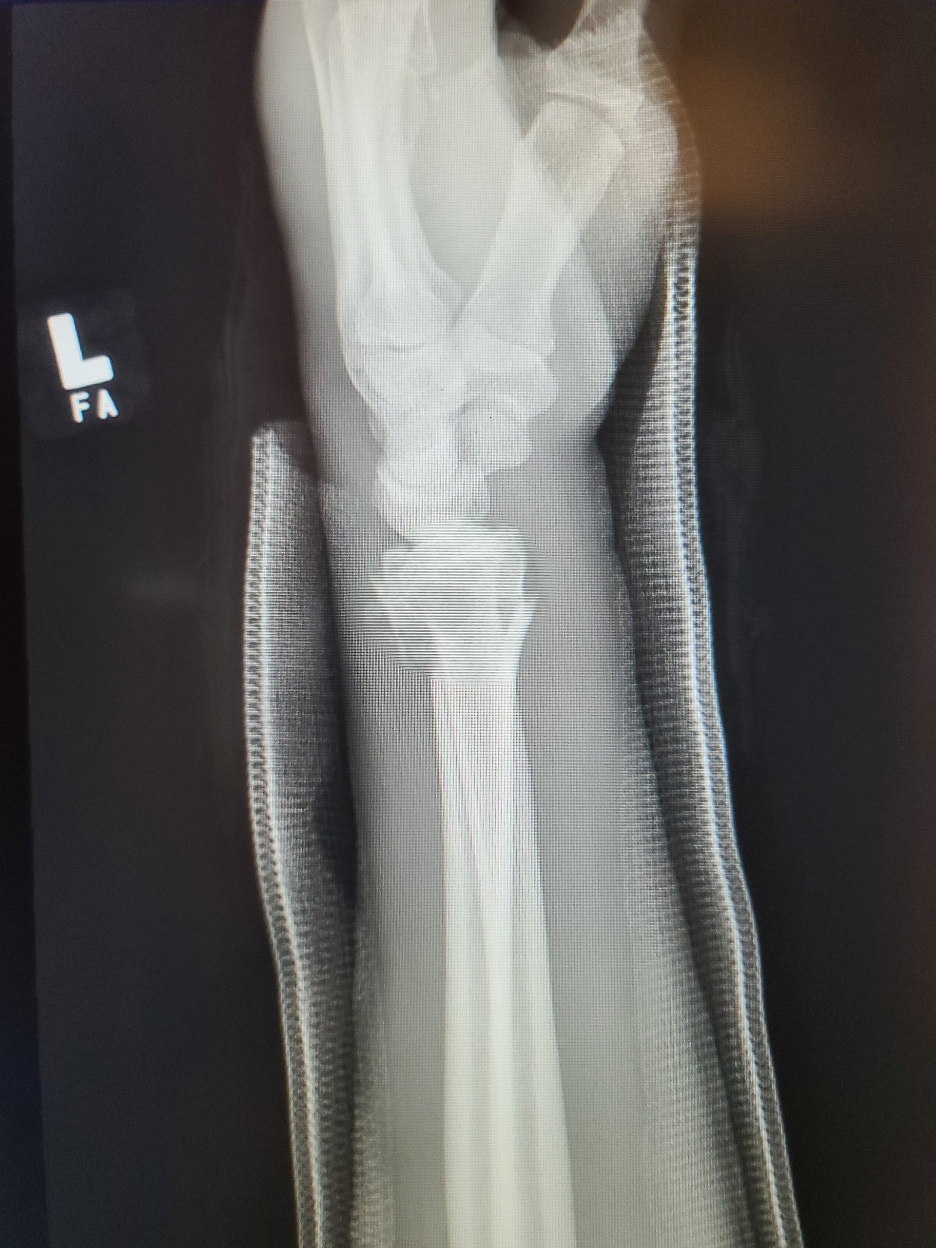 CQ_2025_Injury-03